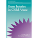 Burn Injuries in Child Abuse