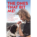 The Ones That Bit Me!: Camels, Cows and Other Young-Vet Stories