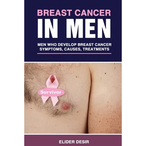 Breast Cancer in Men: Men Who Develop Breast Cancer: Symptoms, Causes and Treatments