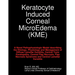 Keratocyte Induced Corneal MicroEdema