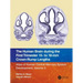 The Human Brain During the First Trimester 15- To 18-MM Crown-Rump Lengths: Atlas of Human Central Nervous System Development, Volume 3