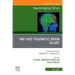 MRI and Traumatic Brain Injury, an Issue of Neuroimaging Clinics of North America: Volume 33-2