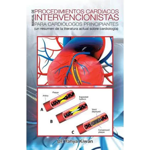 Manual de procedimientos cardiacos intervencionistas para cardiólogos principiantes: (un resumen de la literatura actual sobre cardiología)
