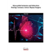Myocardial Ischemia and Infarction During Coronary Artery Bypass Surgery