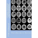 CT Head: DIAGNOSIS A Radiographers Guide To Reporting Part 1 Acute Trauma: Part One Acute Trauma