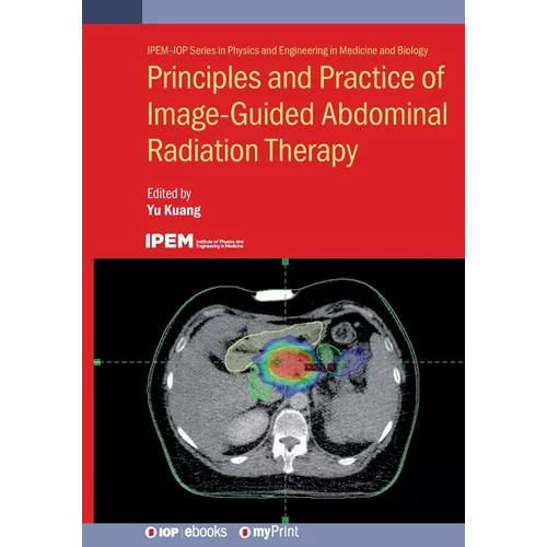 Principles and Practice of Image-Guided Abdominal Radiation Therapy