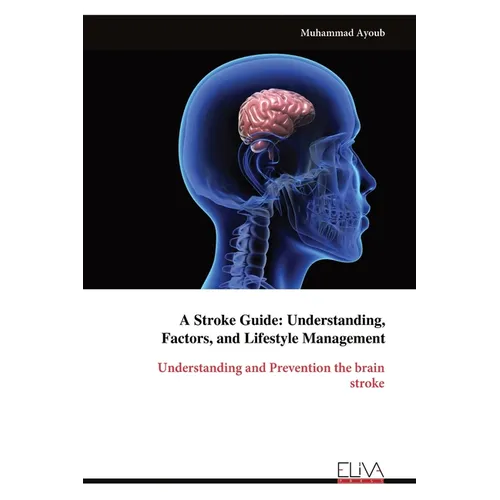 A Stroke Guide: Understanding, Factors, and Lifestyle Management: Understanding and Prevention the brainstroke
