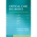 Critical Care EEG Basics