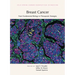 Breast Cancer: From Fundamental Biology to Therapeutic Strategies