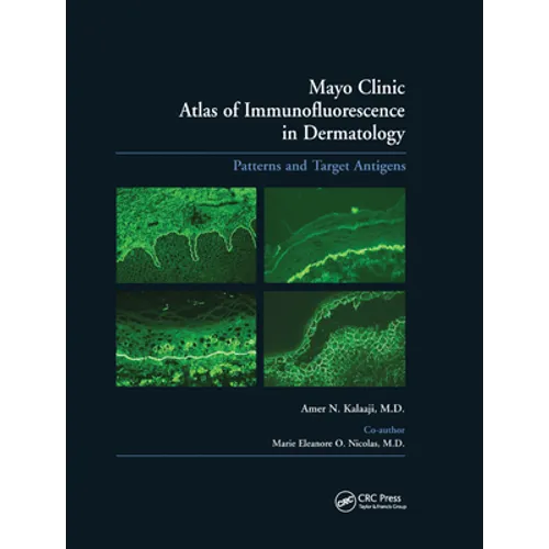 Mayo Clinic Atlas of Immunofluorescence in Dermatology: Patterns and Target Antigens