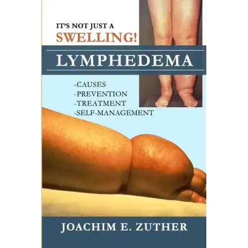 It's Not Just a Swelling! Lymphedema: Causes, Prevention, Treatment, Self-Management