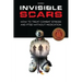 Invisible Scars: How to Treat Combat Stress and PTSD without Medication