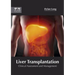 Liver Transplantation: Clinical Assessment and Management