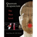 Quantum Acupuncture: - The Next Level