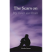 The Scars on my heart and brain