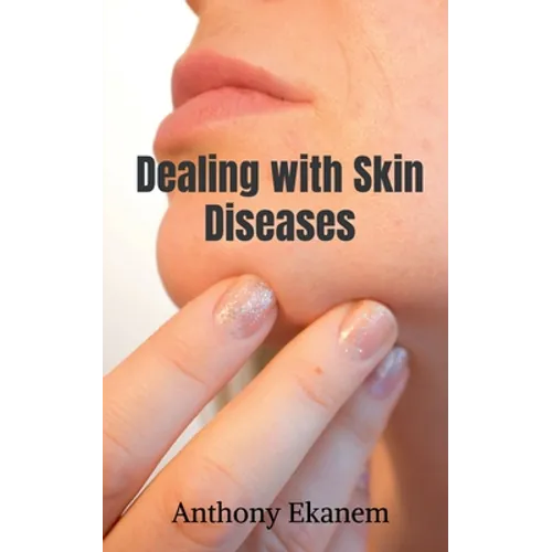 Dealing with Skin Diseases