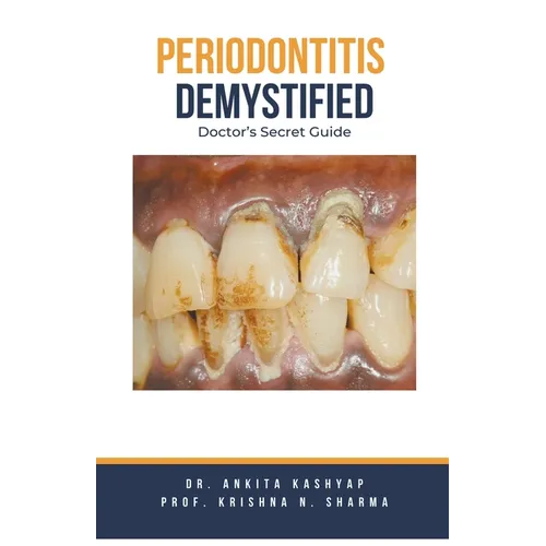 Periodontitis Demystified: Doctor's Secret Guide