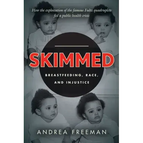 Skimmed: Breastfeeding, Race, and Injustice