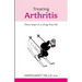 Treating Arthritis: More Ways to a Drug-free Life