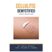 Cellulitis Demystified: Doctor's Secret Guide