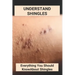 Understand Shingles: Everything You Should Know About Shingles: Shingles Topical Treatment