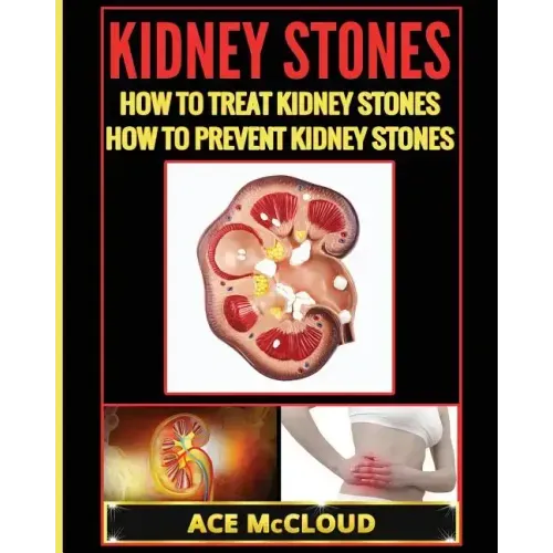 Kidney Stones: How To Treat Kidney Stones: How To Prevent Kidney Stones