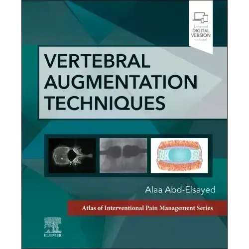 Vertebral Augmentation Techniques
