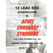 12 Lead ECG Interpretation in Acute Coronary Syndrome with Case Studies from the Cardiac Catheterization Lab