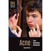 Acne: Your Questions Answered