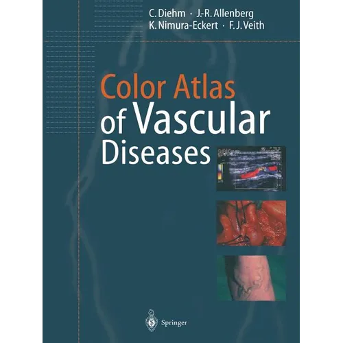 Color Atlas of Vascular Diseases