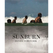 Sunburn