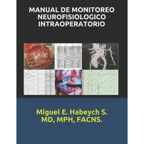 Manual de Monitoreo Neurofisiológico Intraoperatorio.