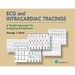 ECG and Intracardiac Tracings: A Toolkit Approach for Analyzing Arrhythmias