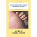 Tips On How To Treat Eczema And Relieve Dry Skin: Get Rid Of Eczema Forever: Overcome Eczema