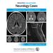 Pediatric Collections: Neurology Cases: Case Reports from Pediatrics in Review