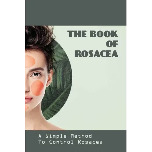 The Book Of Rosacea- A Simple Method To Control Rosacea: Rosacea Treatment For Face