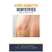 Atopic Dermatitis Demystified: Doctor's Secret Guide