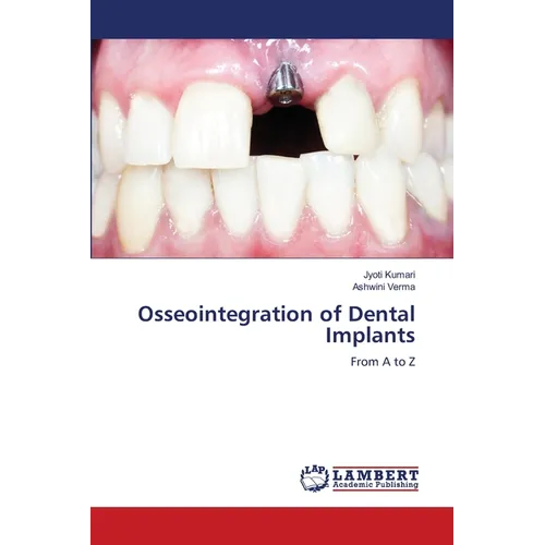 Osseointegration of Dental Implants