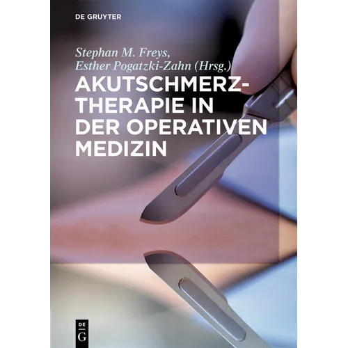 Akutschmerztherapie in Der Operativen Medizin