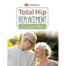 Total Hip Replacement: It's a Joint Effort