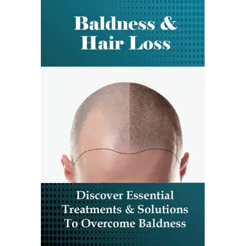 Baldness & Hair Loss: Discover Essential Treatments & Solutions To Overcome Baldness: How To Prevent Hair Loss For Guys