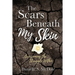 The Scars Beneath My Skin: Overcoming the Struggle Within