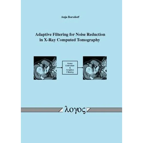 Adaptive Filtering for Noise Reduction in X-Ray Computed Tomography