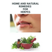 Home and Natural Remedies for Herpes: The Best Herbal And Natural Remedies To Get Rid Of All Form Of Herpes Virus
