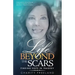 Life Beyond the Scars: Finding Hope in Tragedy
