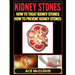 Kidney Stones: How To Treat Kidney Stones: How To Prevent Kidney Stones