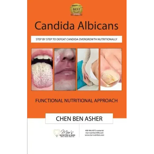 Candida Albicans: Step by Step to Defeat Candida Overgrowth Nutritionally