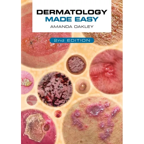Dermatology Made Easy, Second Edition