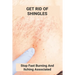 Get Rid Of Shingles: Stop Fast Burning And Itching Associated: Shingles On Face Treatment