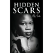 Hidden Scars: My Truth